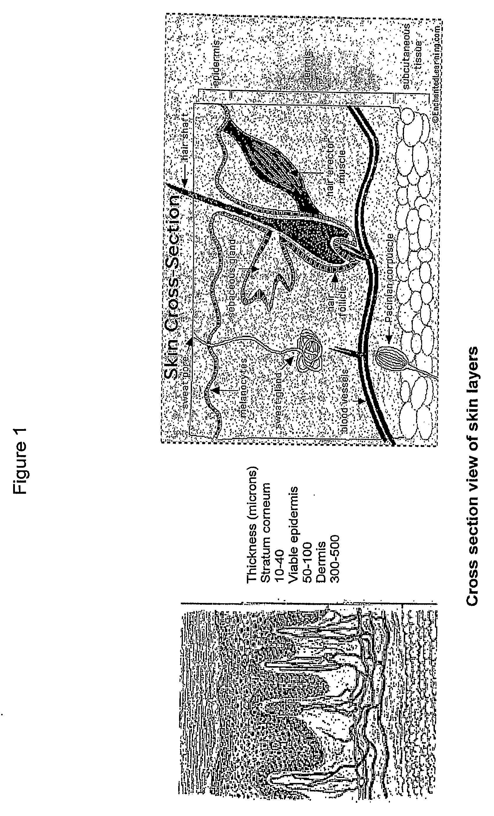 Topical adminstration of acyclovir