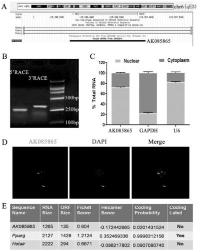 Application of IncRNA in regulating polarization of macrophages in viral myocarditis