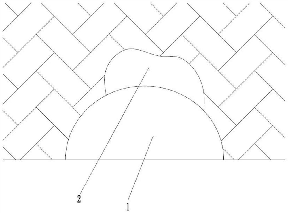 Anti-sloughing device for top unstable exposed karst cave in tunnel construction and construction method