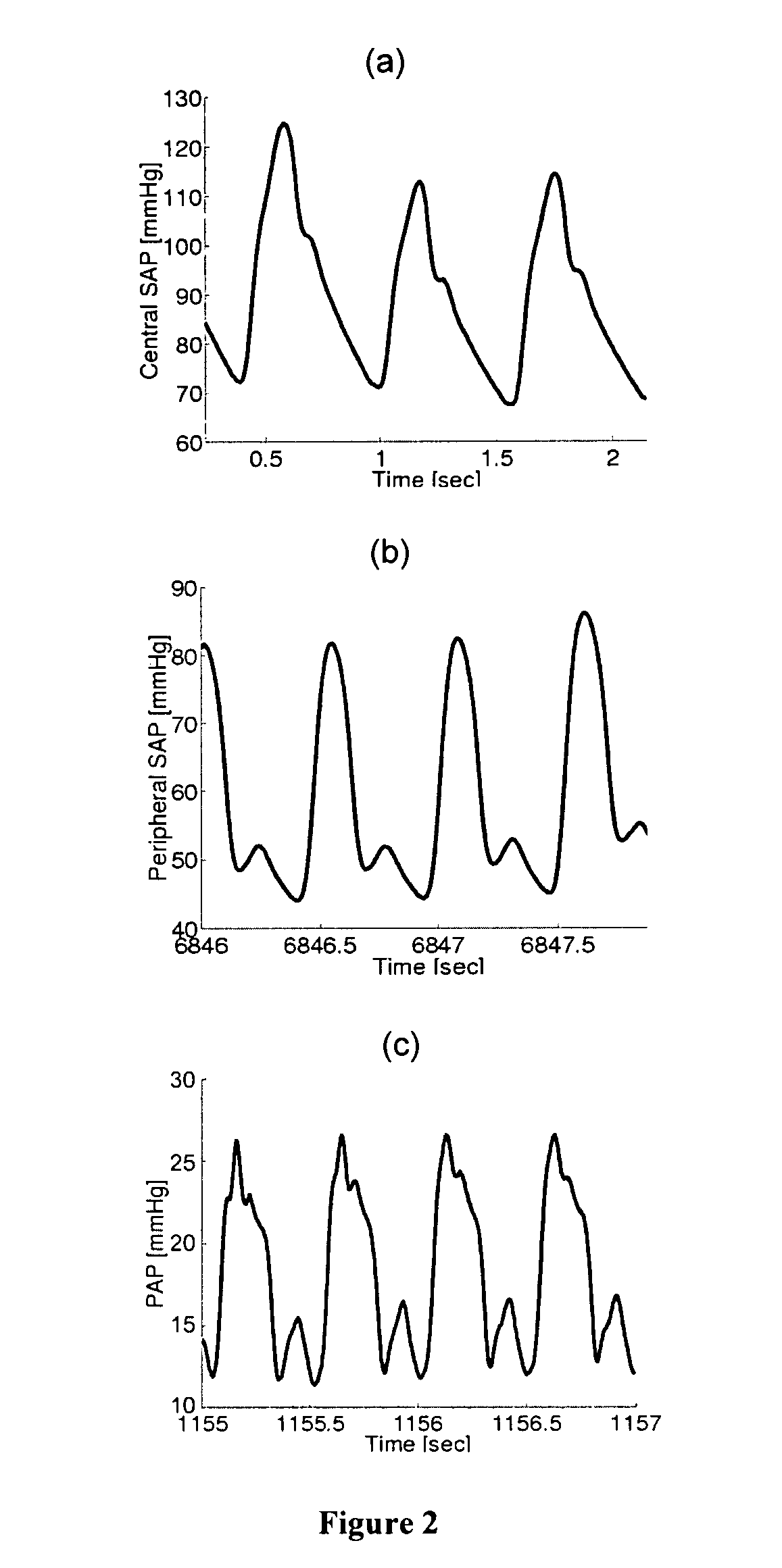 Methods and apparatus for determining cardiac output and left atrial pressure
