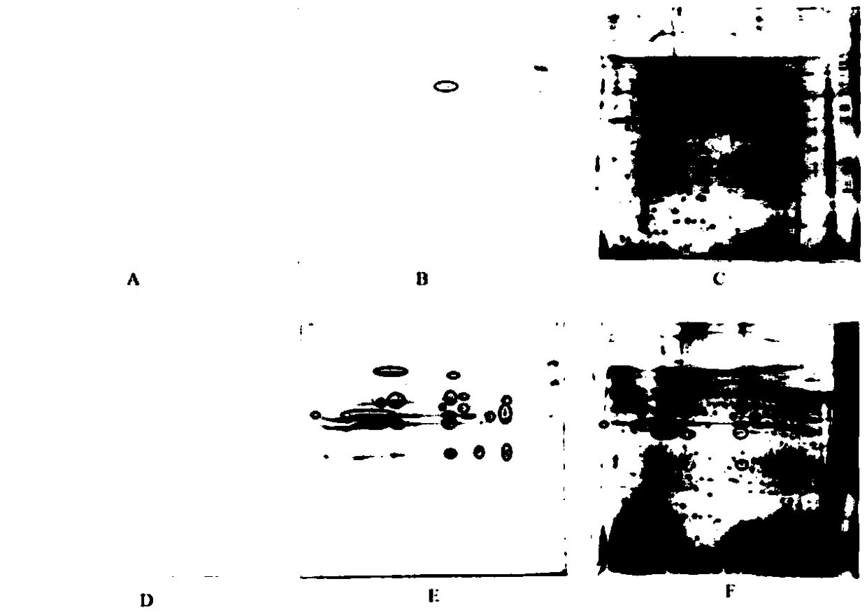 Babesia mocroti 2D41 antigen protein and application thereof