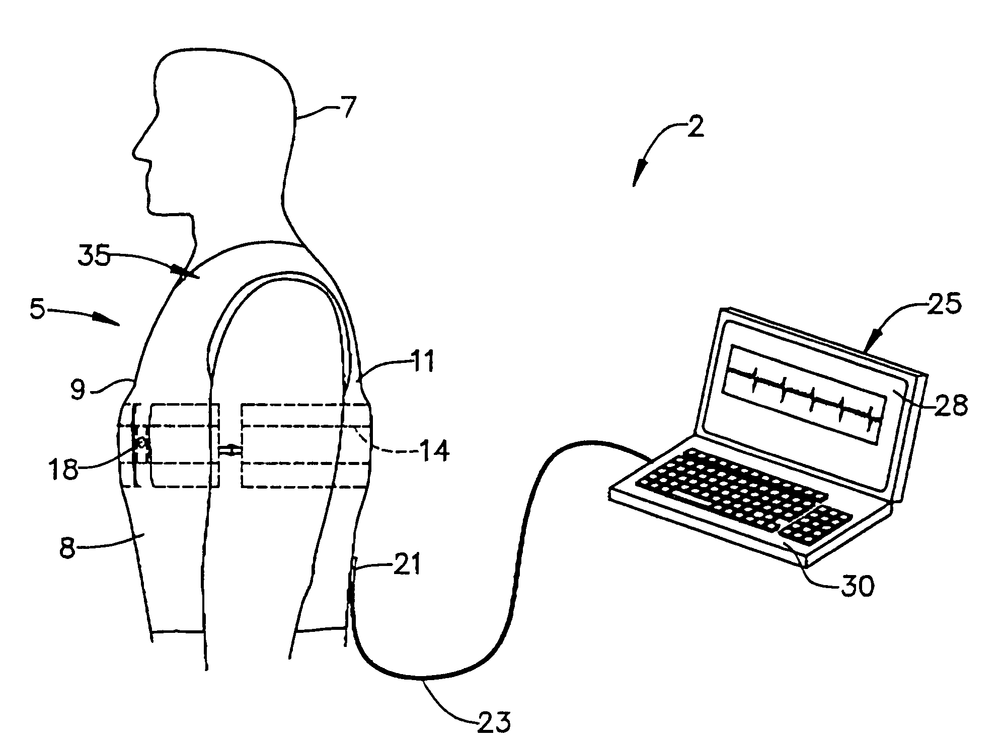 Garment incorporating embedded physiological sensors