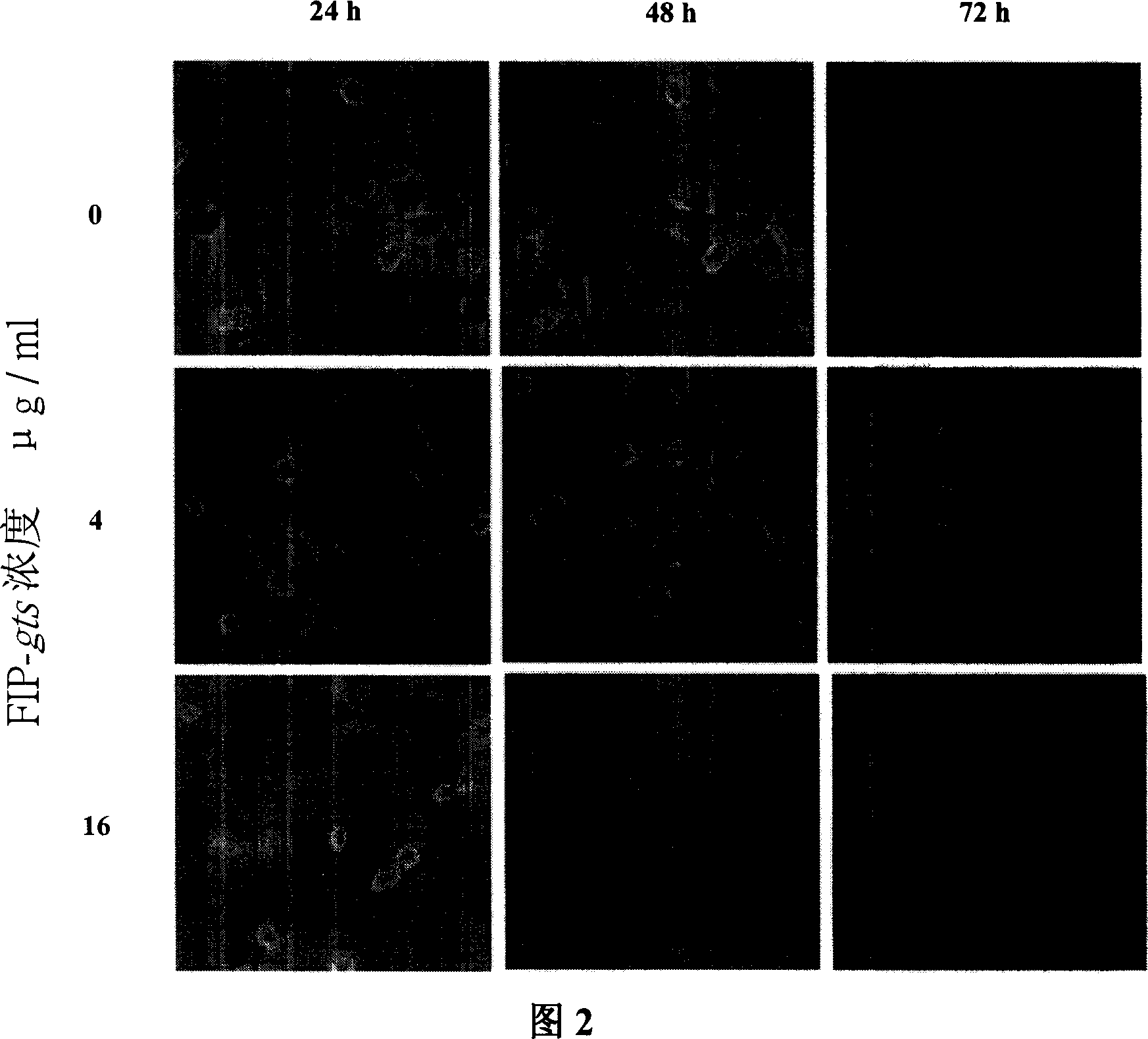 Use of fungal immunomodulatory protein