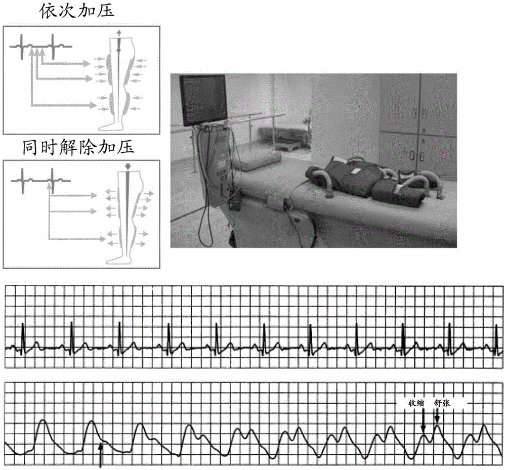 Method and system for evaluating automatic regulation function of cerebral blood flow through external counterpulsation technique