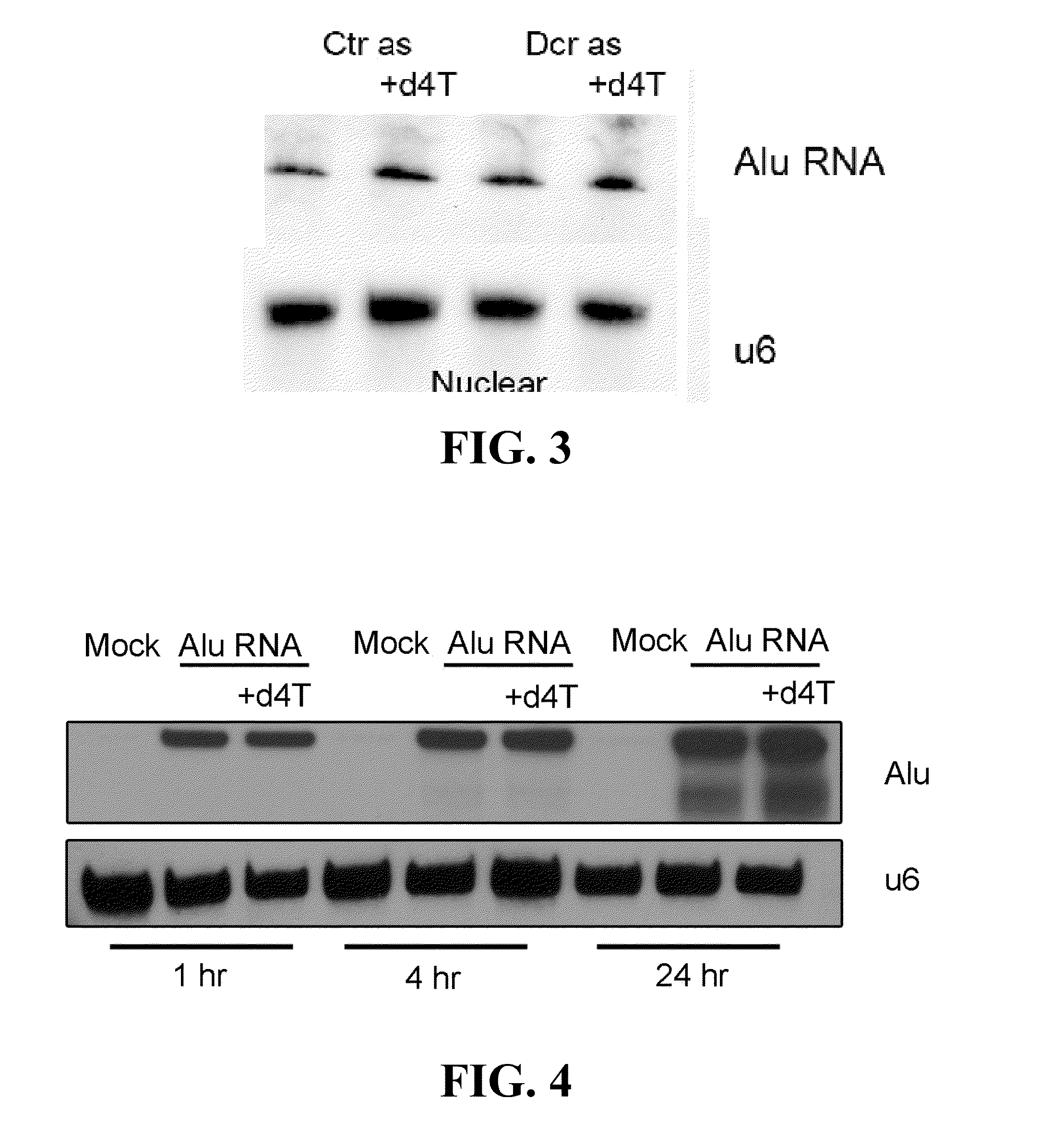 Compositions and methods for treating retinal degradation