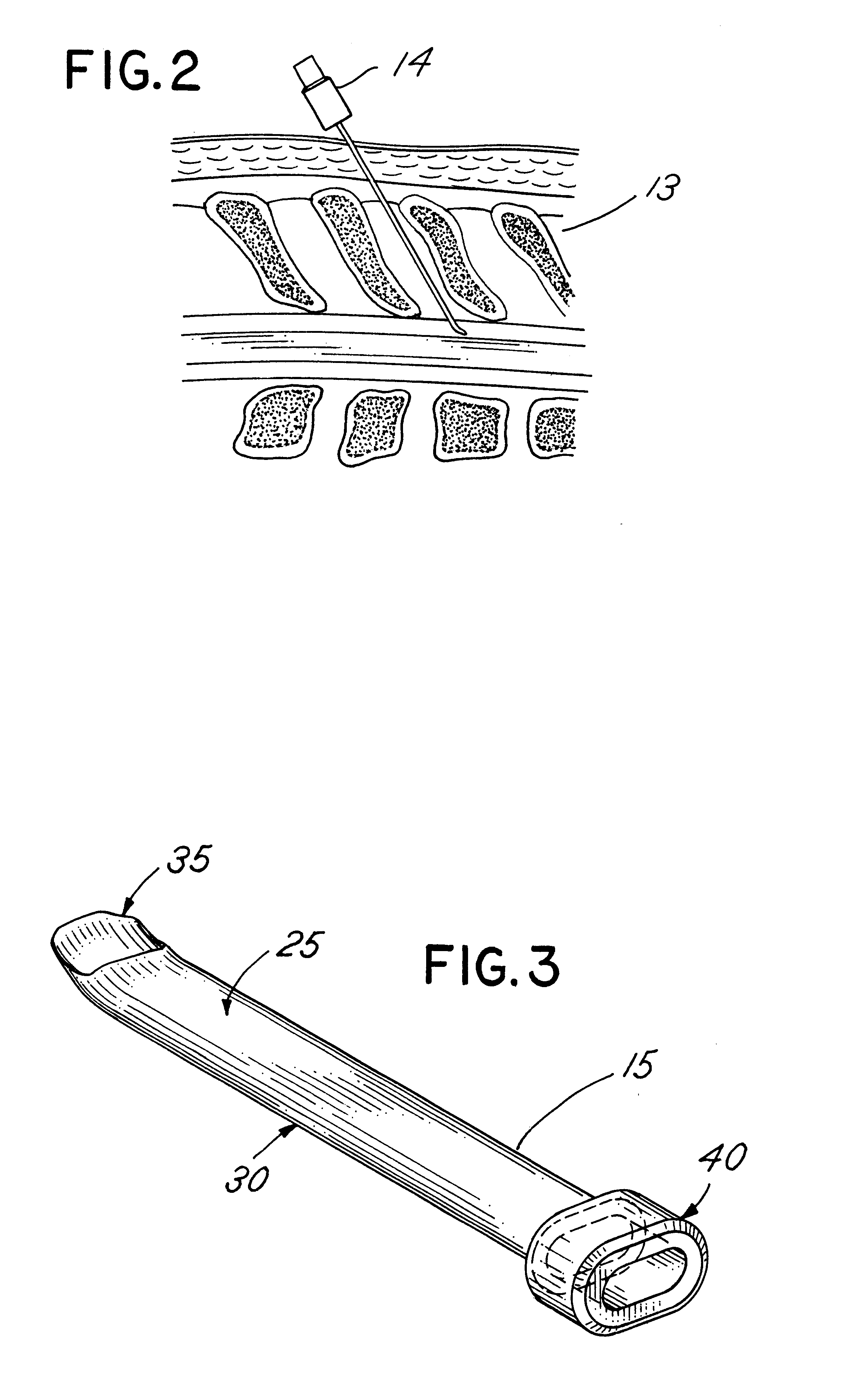 Apparatus and method for percutaneous implant of a paddle style lead