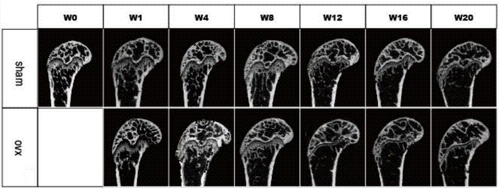 MiRNA (micro Ribonucleic Acid) marker and kit related to postmenopausal osteoporosis