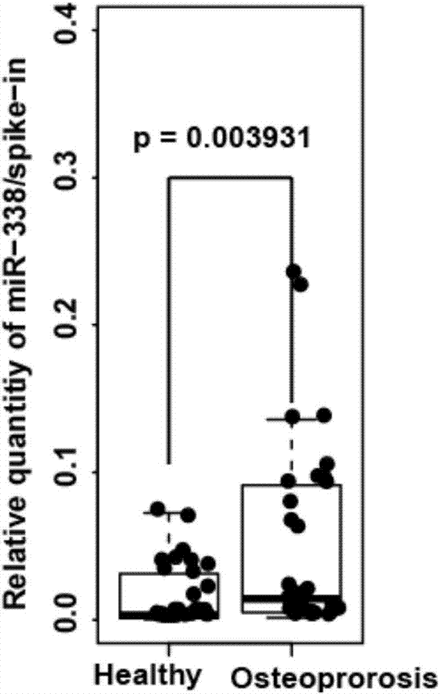 MiRNA (micro Ribonucleic Acid) marker and kit related to postmenopausal osteoporosis