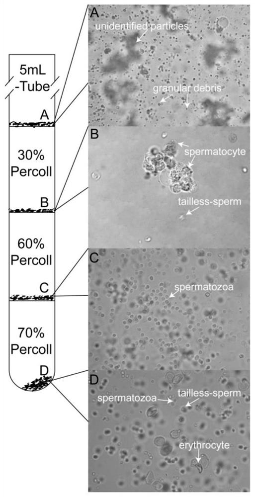 A method for cryopreservation of elongated semen and its dilution