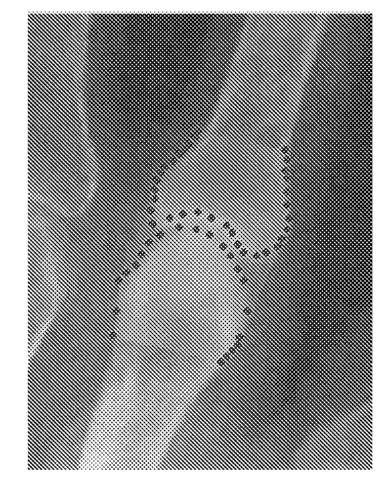 Computer program products and methods for detection and tracking of rheumatoid arthritis