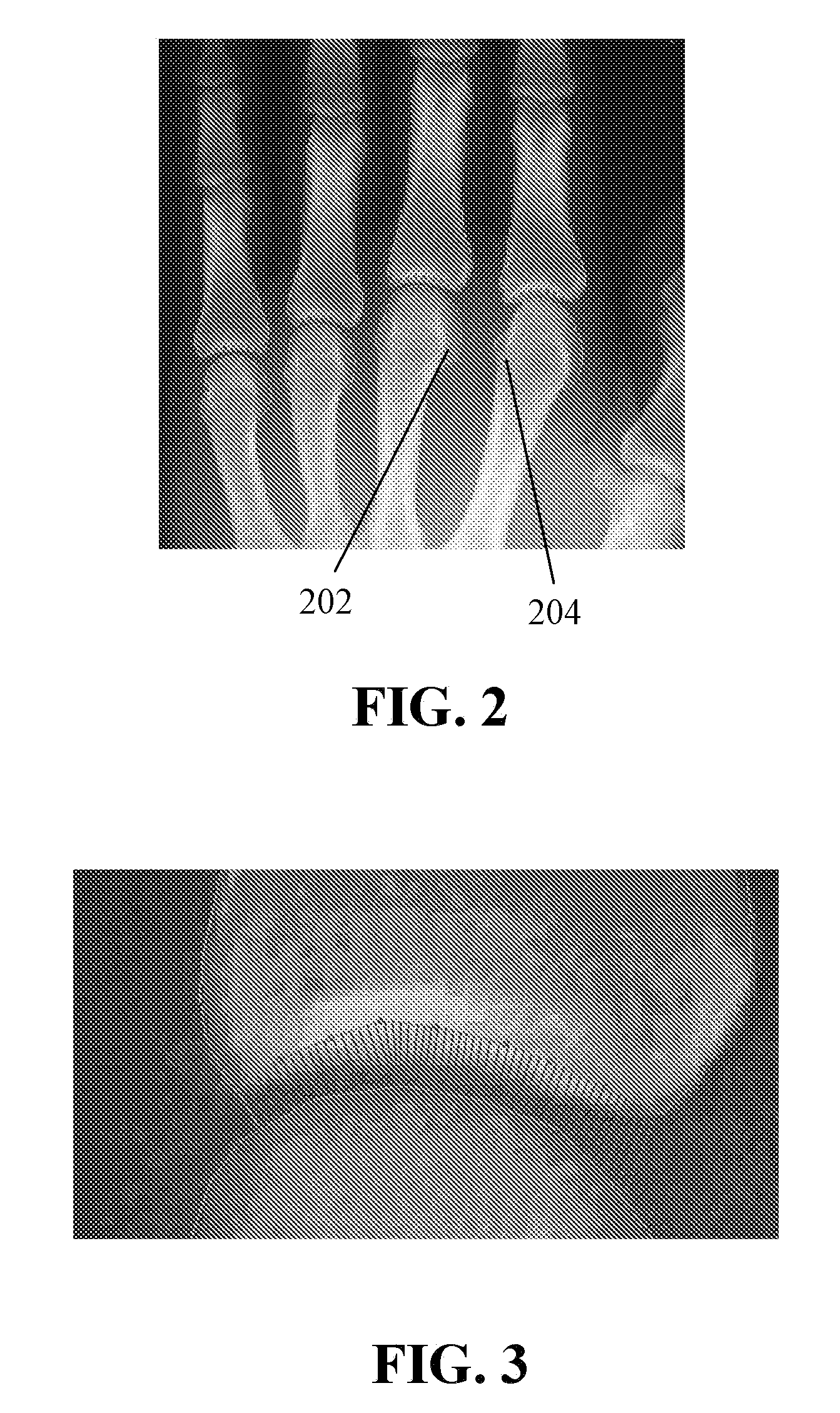 Computer program products and methods for detection and tracking of rheumatoid arthritis