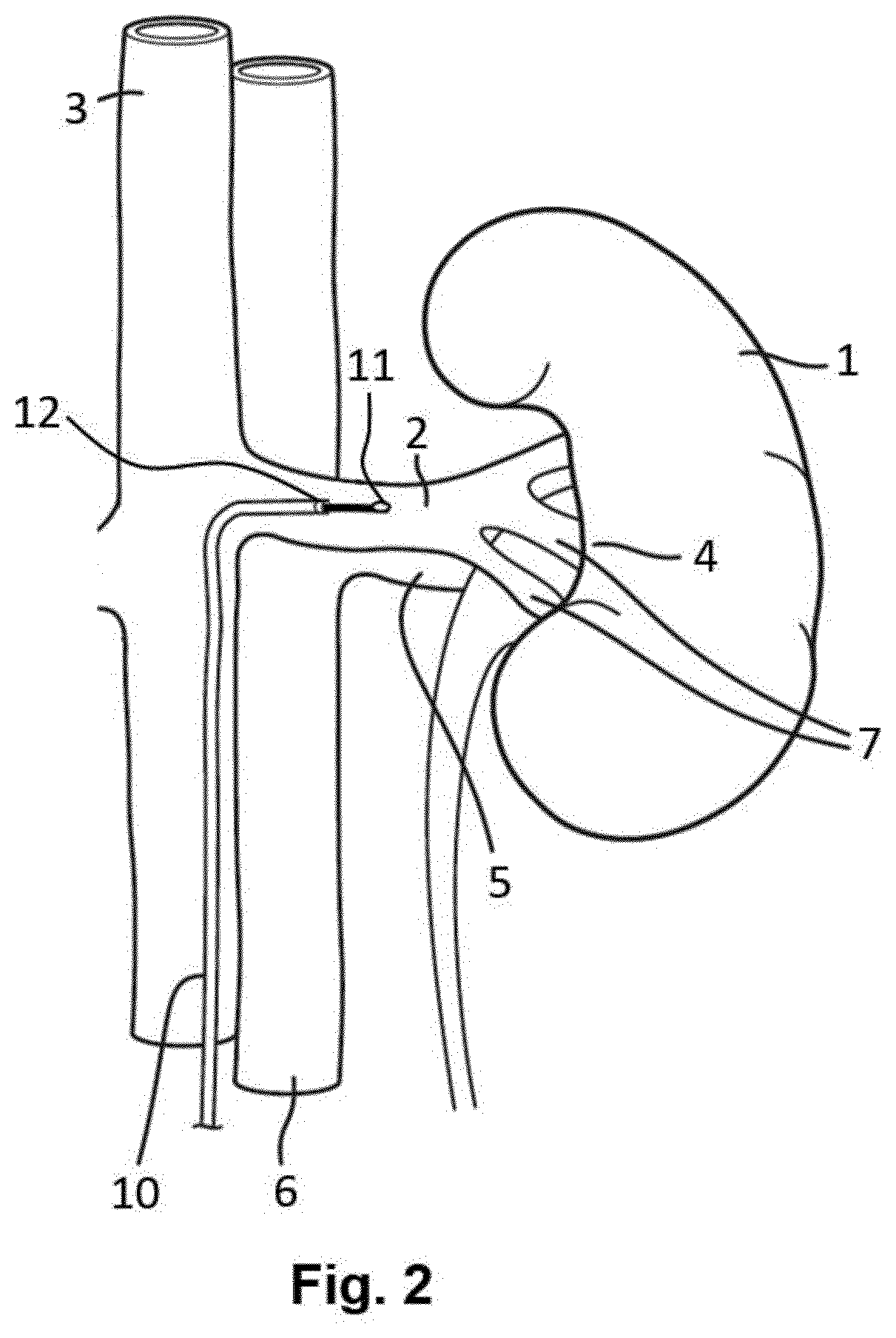 System and method for determining pulse wave velocity of vessels