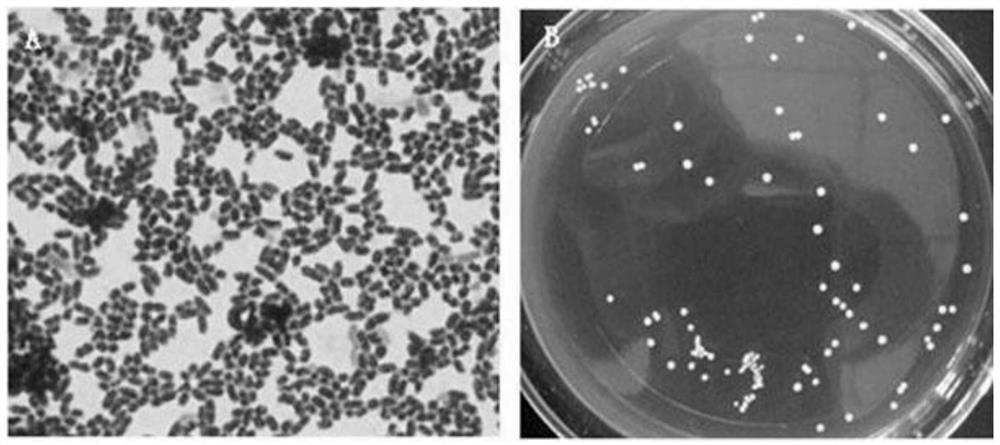 A strain of Lactobacillus plantarum with antibacterial properties and its application in the prevention of diarrhea