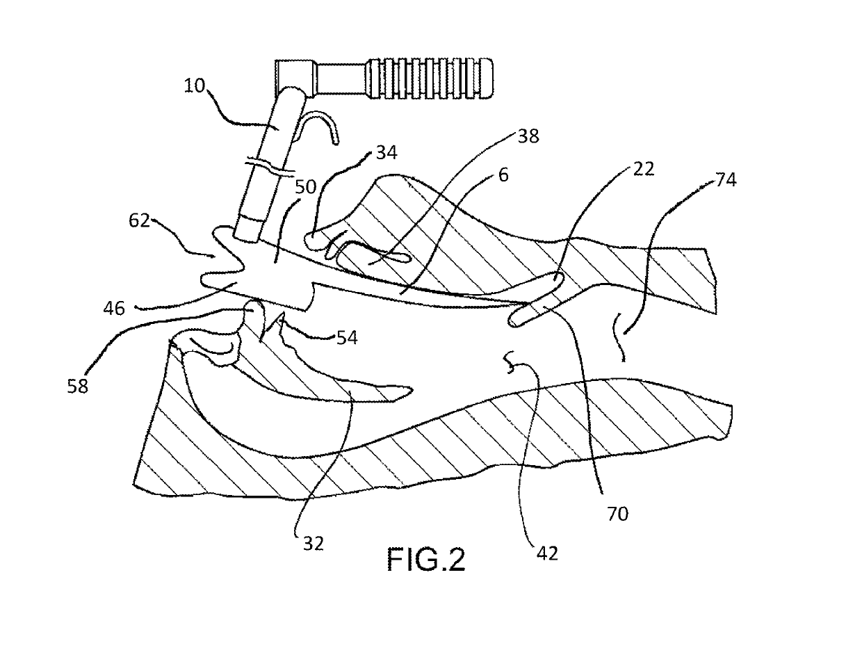 Retractor and tip extender therefor