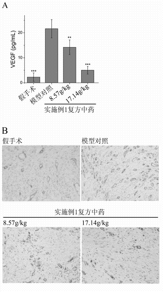 Compound traditional Chinese medicine for treating endometriosis and preparation method and application thereof