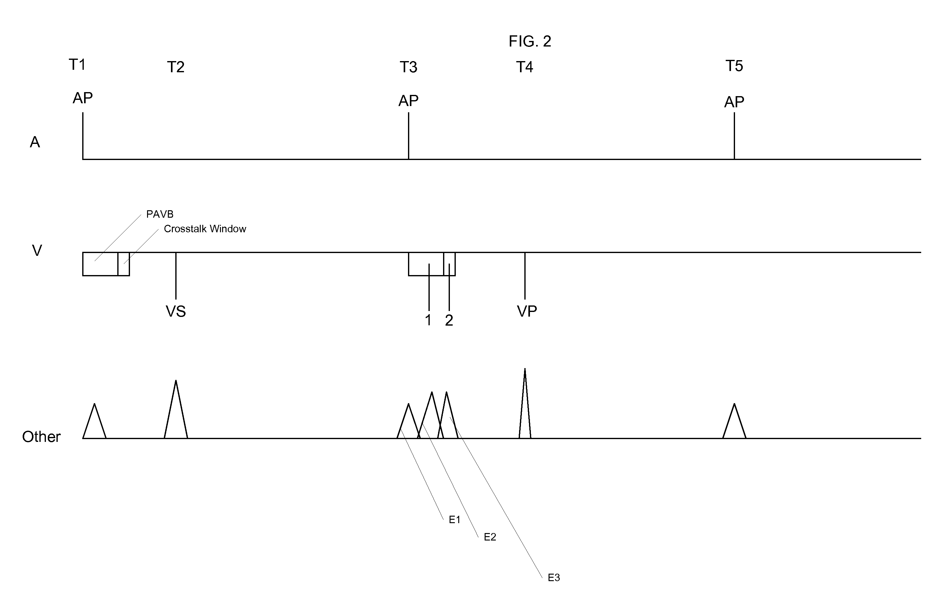 System and Method for Providing Improved Atrial Pacing Based on Physiological Need