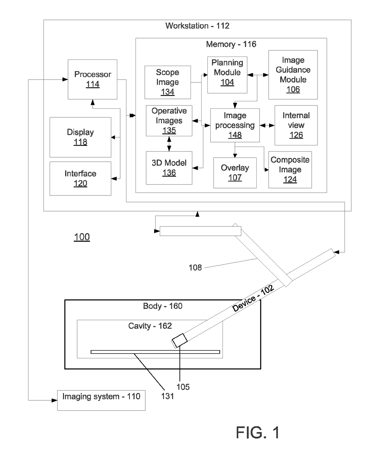 Spatial visualization of internal mammary artery during minimally invasive bypass surgery