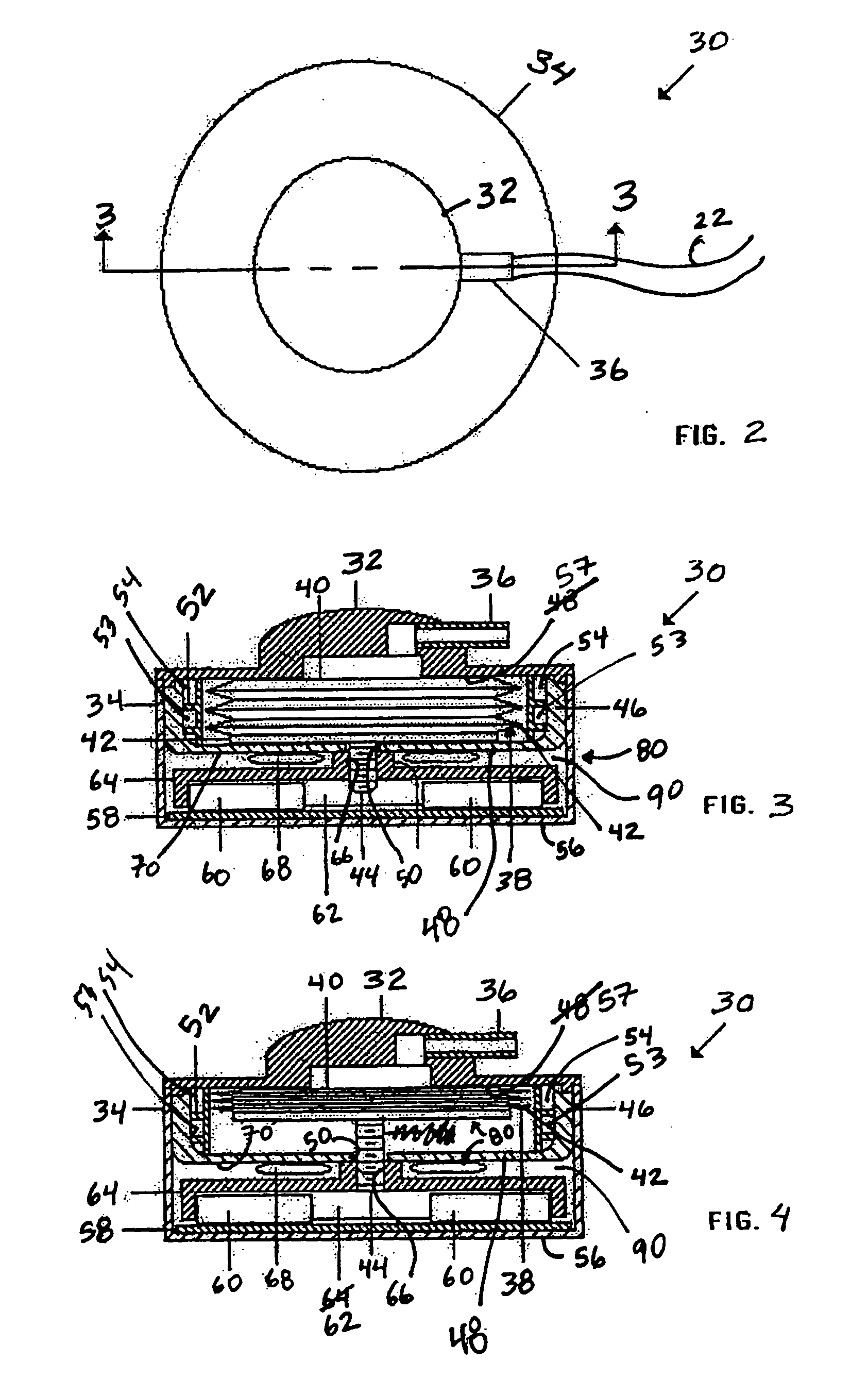 Metal bellows position feedback for hydraulic control of an adjustable gastric band