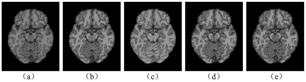 Brain MR Image Segmentation Method Combining Weighted Neighborhood Information and Offset Field Restoration