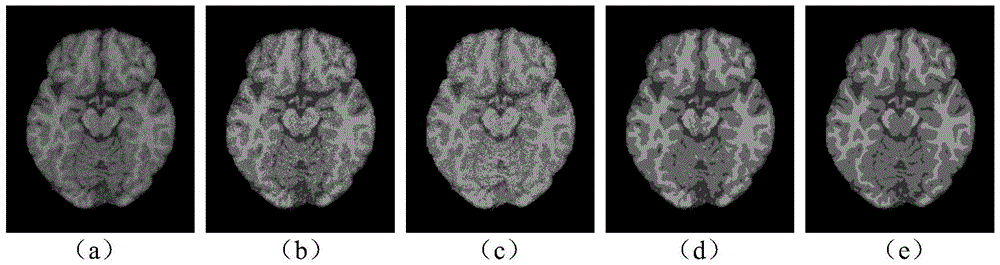 Brain MR Image Segmentation Method Combining Weighted Neighborhood Information and Offset Field Restoration