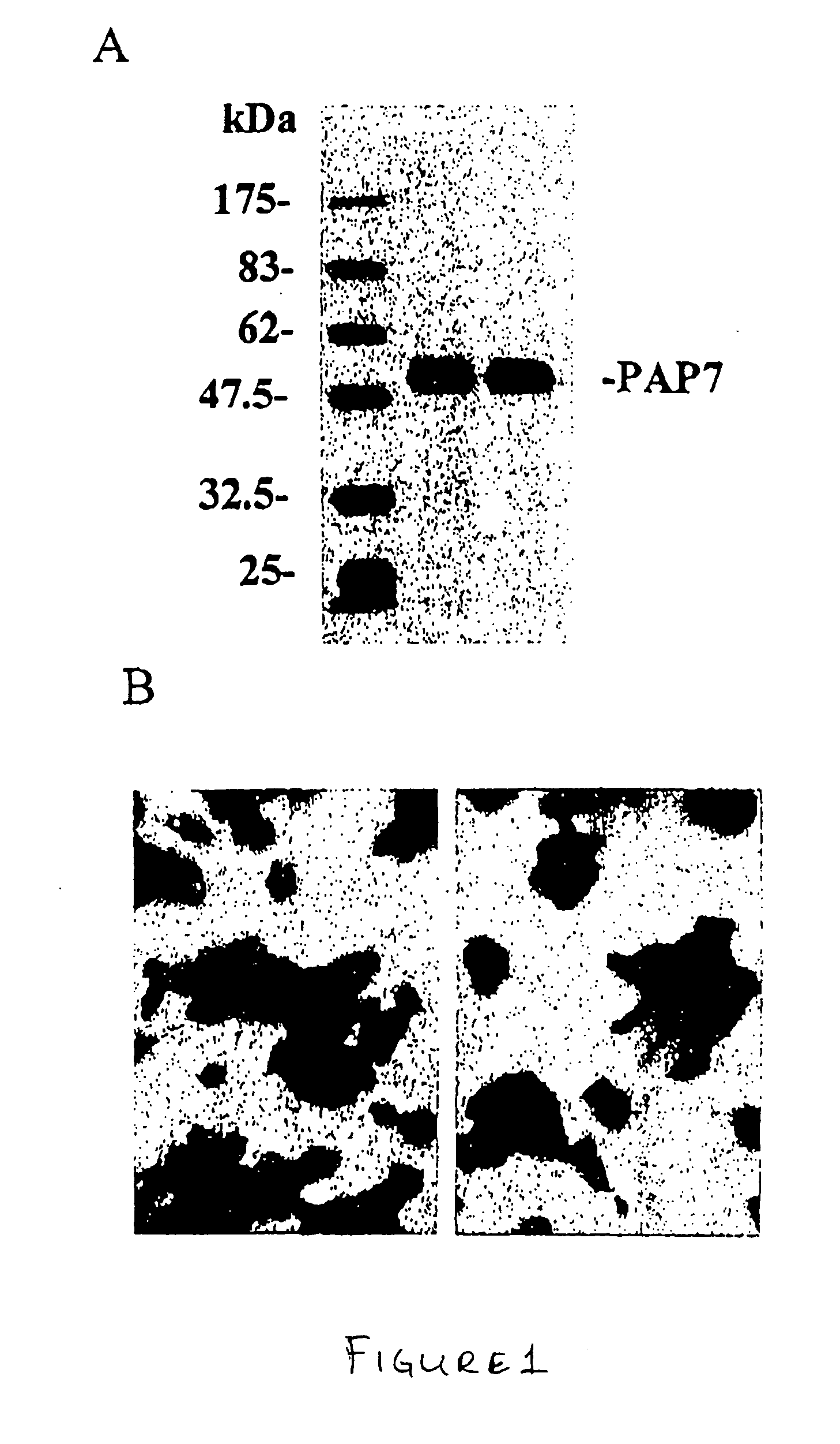 Peripheral-type benzodiazepine receptor associated proteins, cloning, expression and methods of use