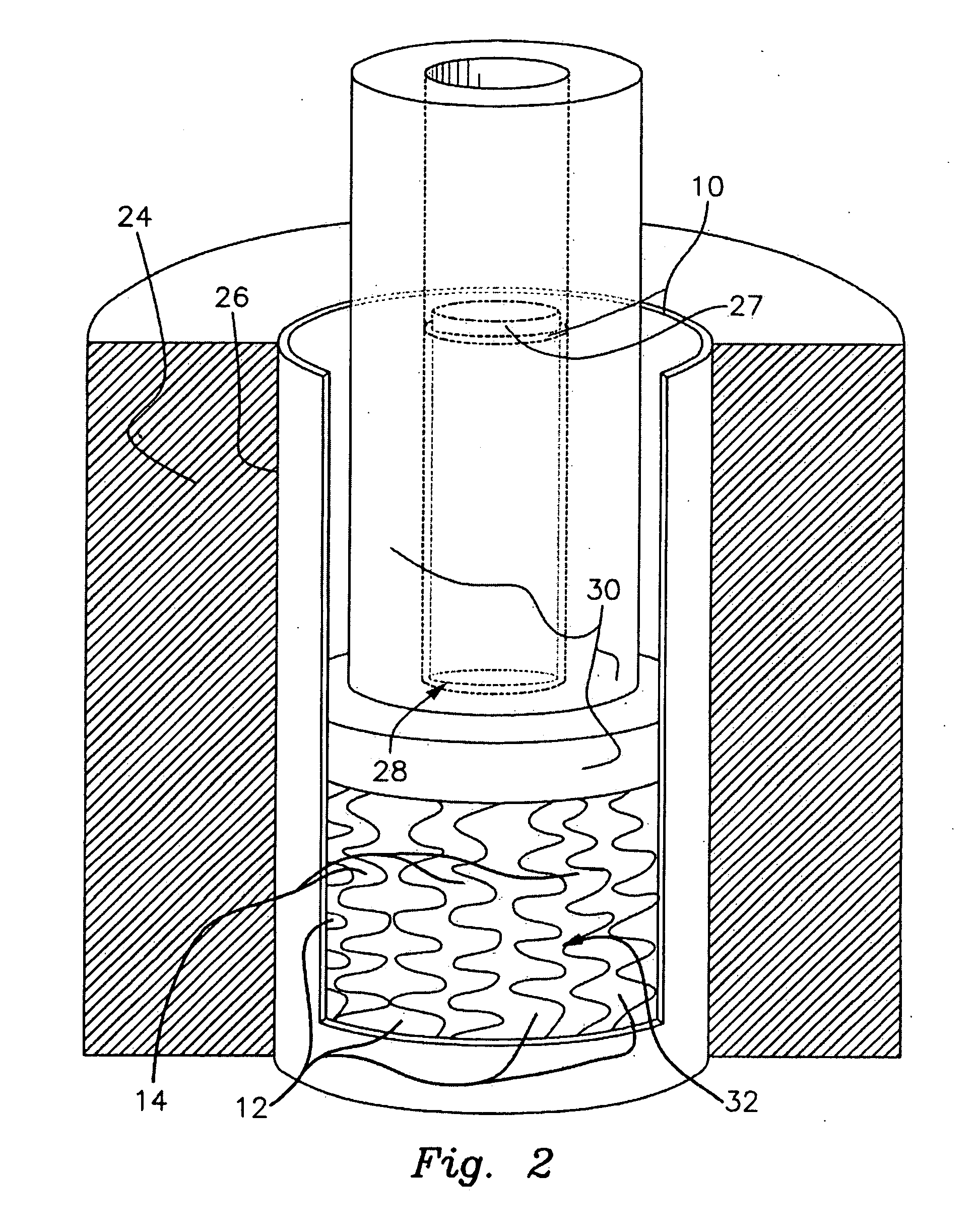 Composite metal tube and ring and a process for producing a composite metal tube and ring