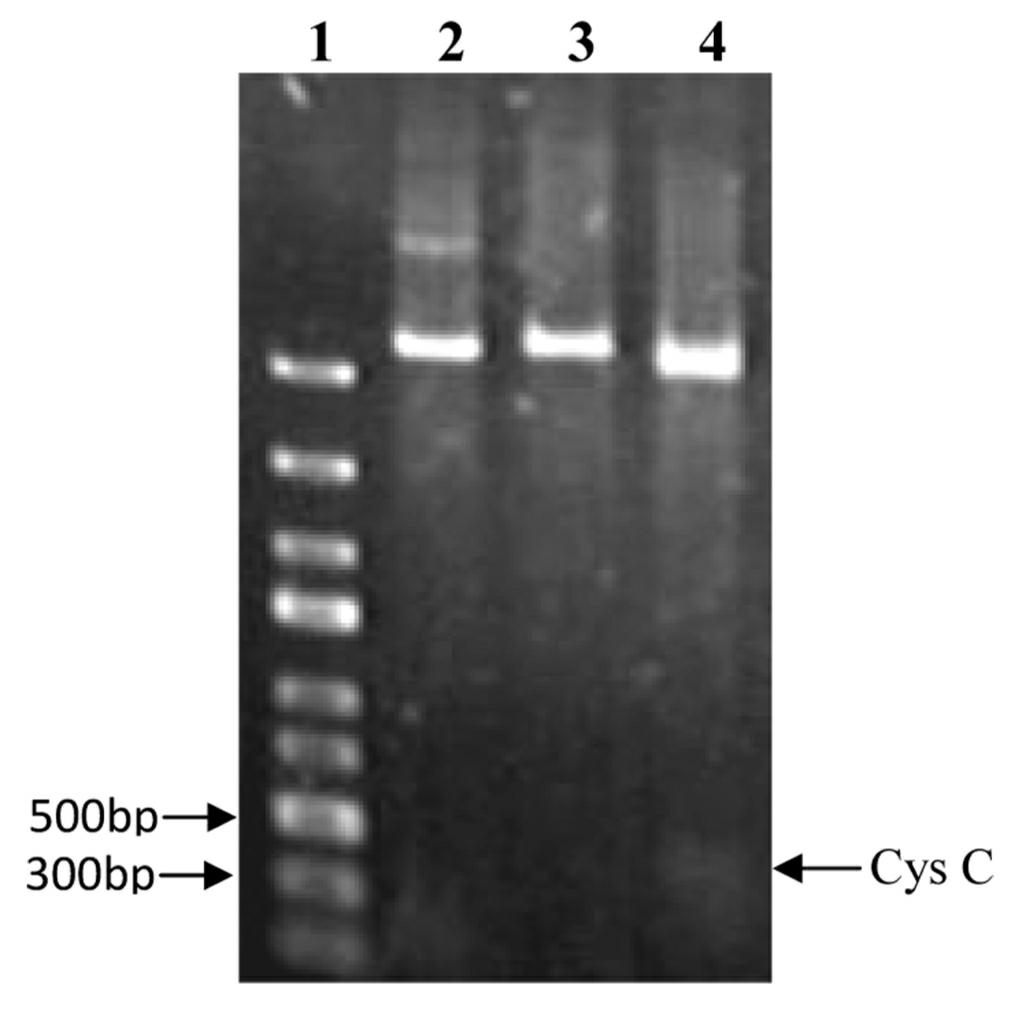 Recombinant human cystatin C coding gene and expression method