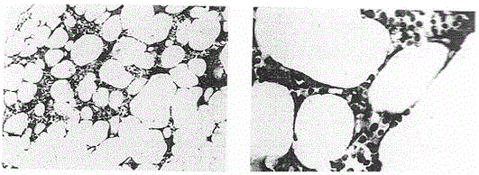 Cell-based biological drug for allogeneic adoptive cellular immunotherapy for hematological diseases and preparation method