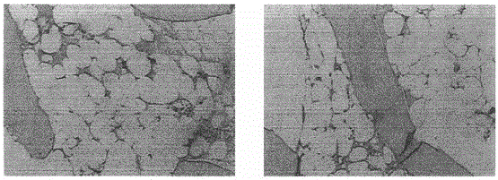 Cell-based biological drug for allogeneic adoptive cellular immunotherapy for hematological diseases and preparation method