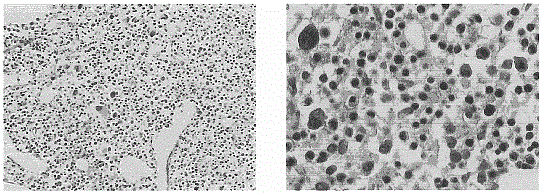 Cell-based biological drug for allogeneic adoptive cellular immunotherapy for hematological diseases and preparation method