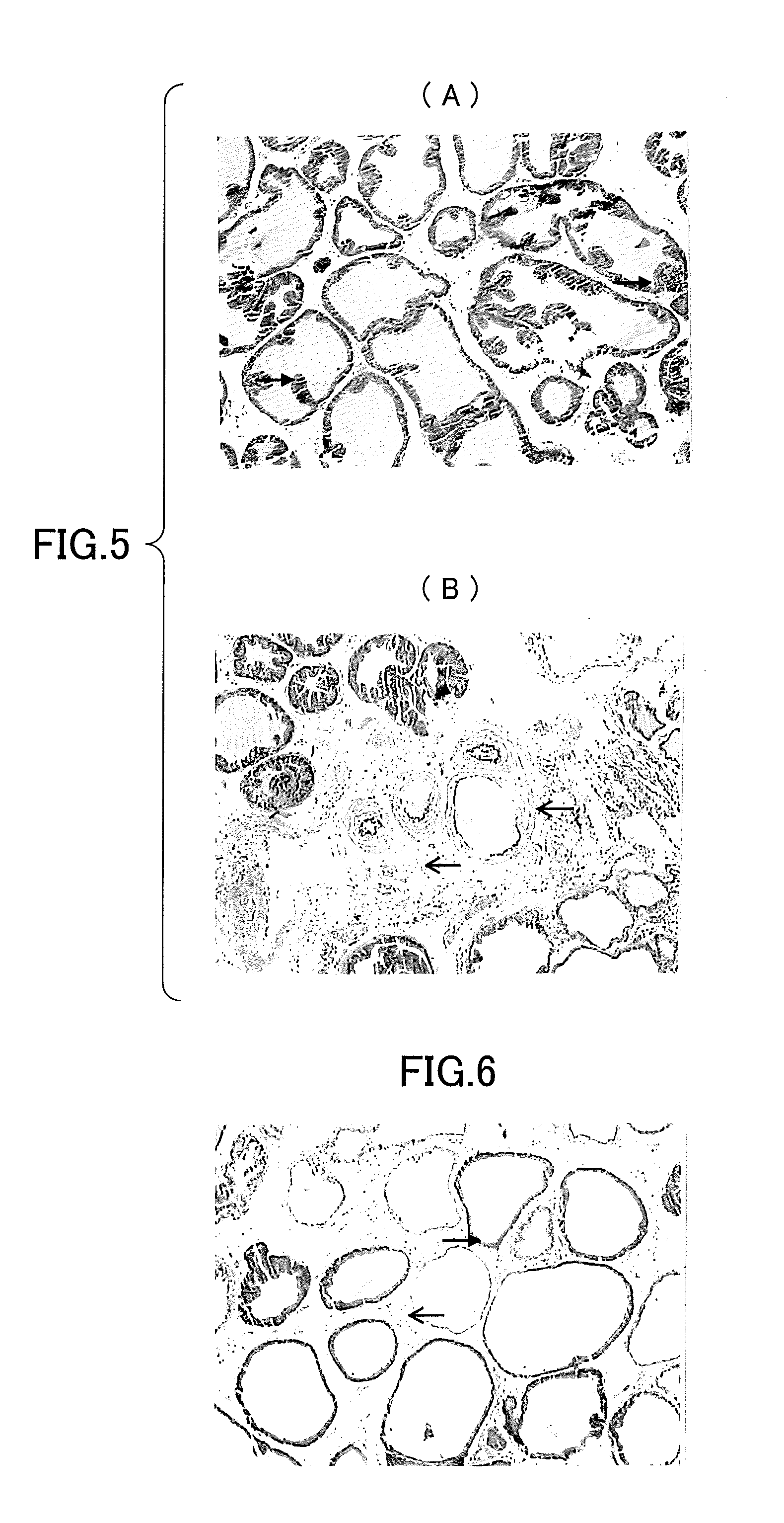 Therapeutic agent for a lower urinary tract disease and an agent for improving a lower urinary tract symptom