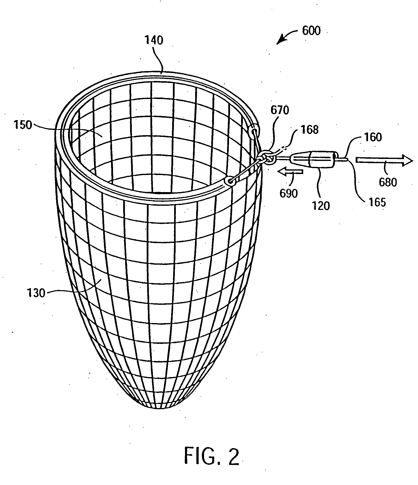 Apparatus and methods for cardiac restraint