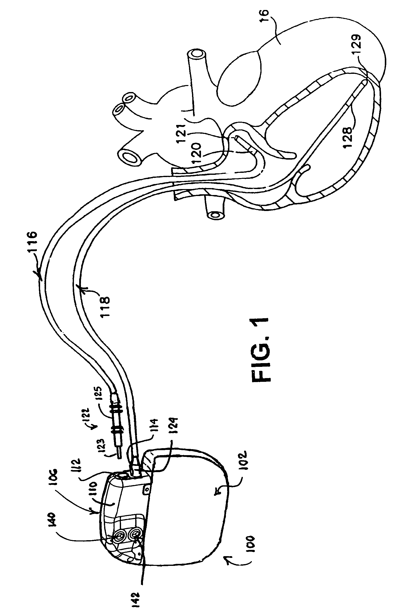 Connector header grommet for an implantable medical device