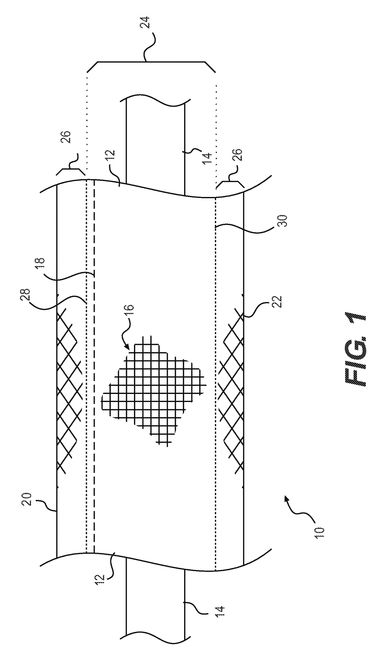 Wire casing and method of making the same