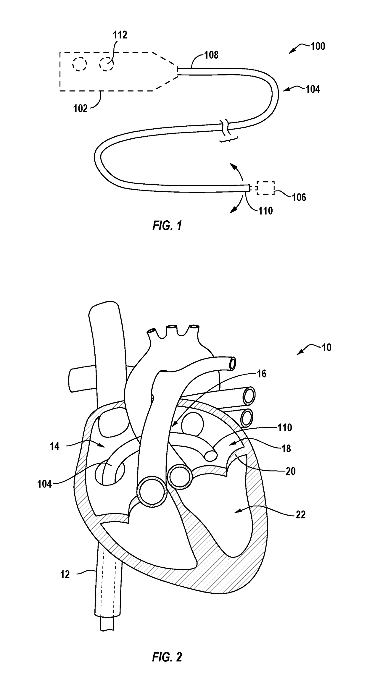 Intravascular delivery system with centralized steering