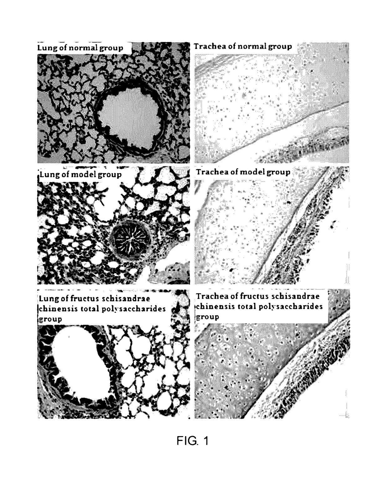 Application of fructus schisandrae total polysaccharides in preparatoin of medicine or nutraceuticals used for treating coughing