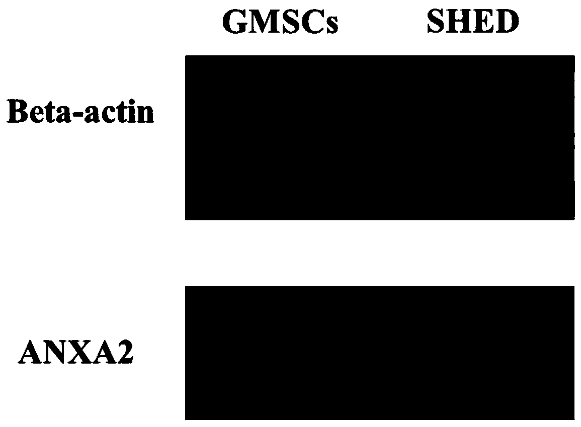 Marker for distinguishing gingival stem cells and deciduous tooth pulp stem cells and application thereof