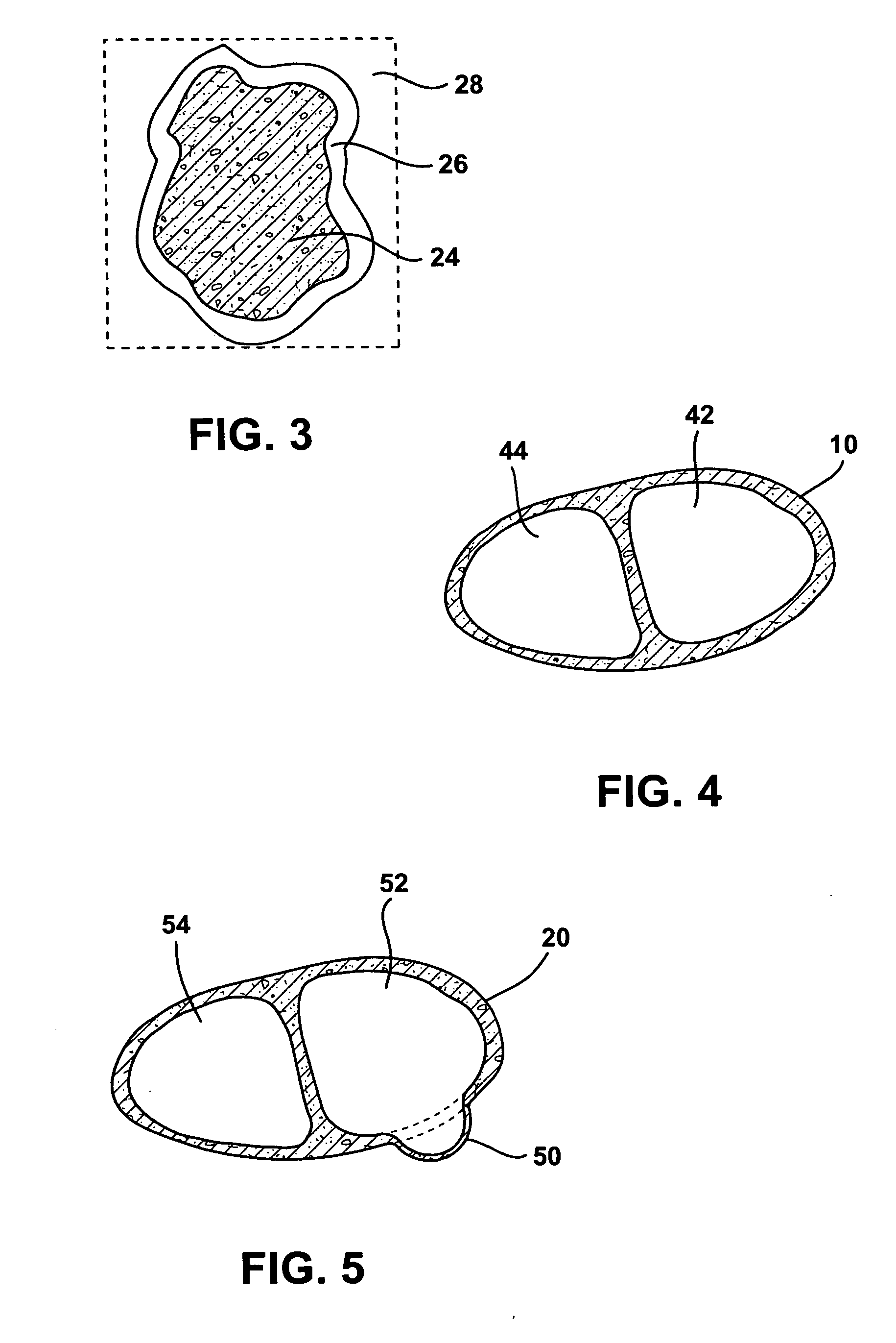 Methods and systems for treating injured cardiac tissue