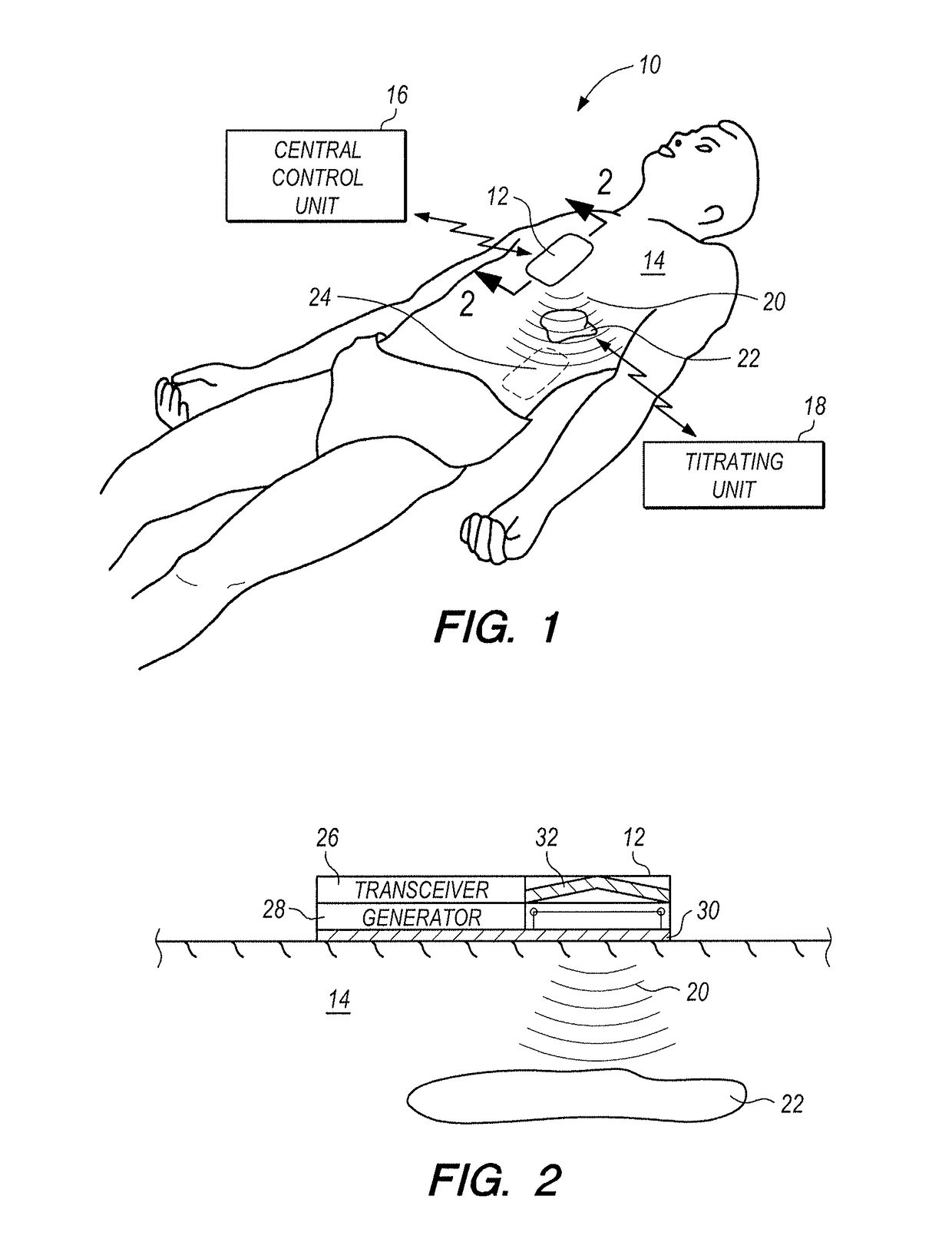 System and method for titrating in vivo cellular reaction and gene expression using varying oscillation frequencies