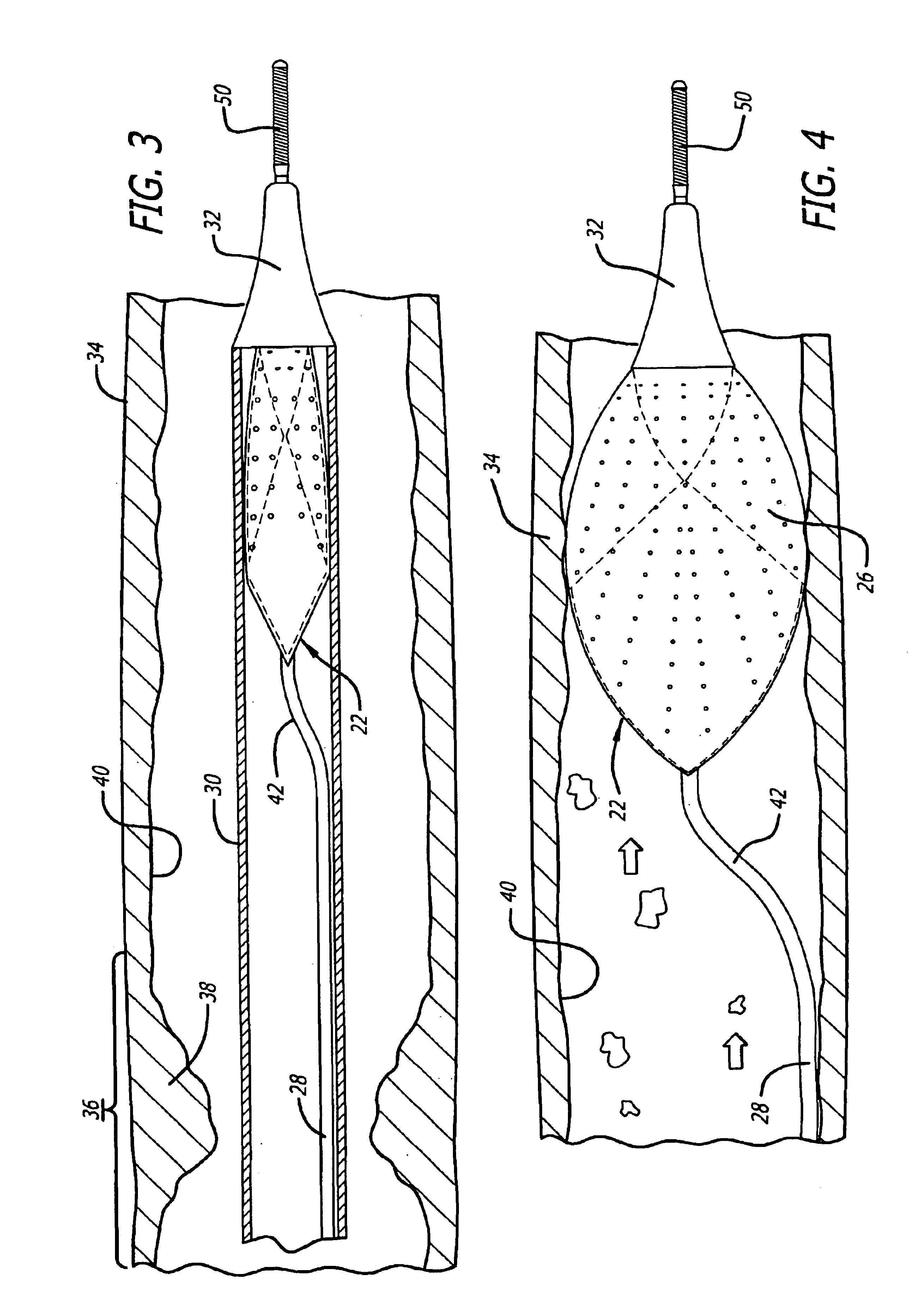 Offset proximal cage for embolic filtering devices