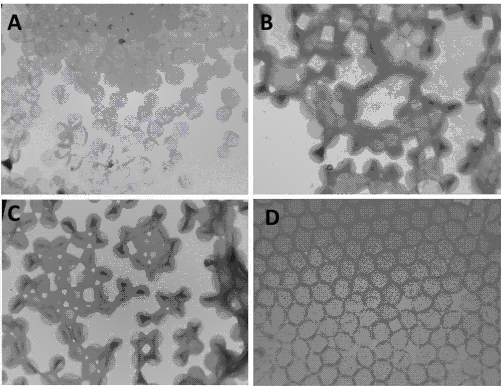 Preparation method and use of degradable polymer nano-microcapsules