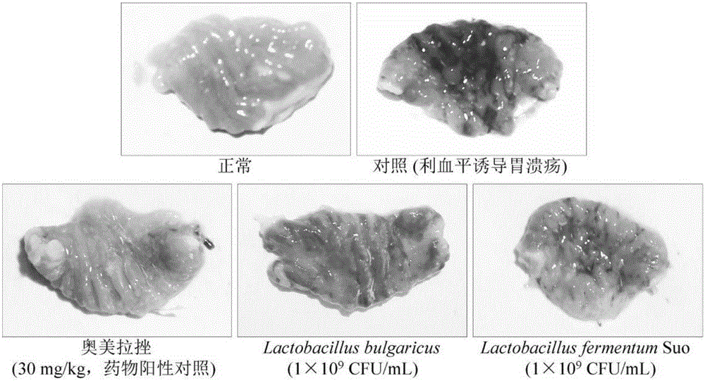Lactobacillus fermentum suo strain capable of preventing gastrohelcoma and health-care application thereof