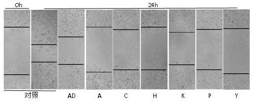 Application of andrographolide derivatives and their 3,19 esters in the preparation of anti-hepatic fibrosis drugs