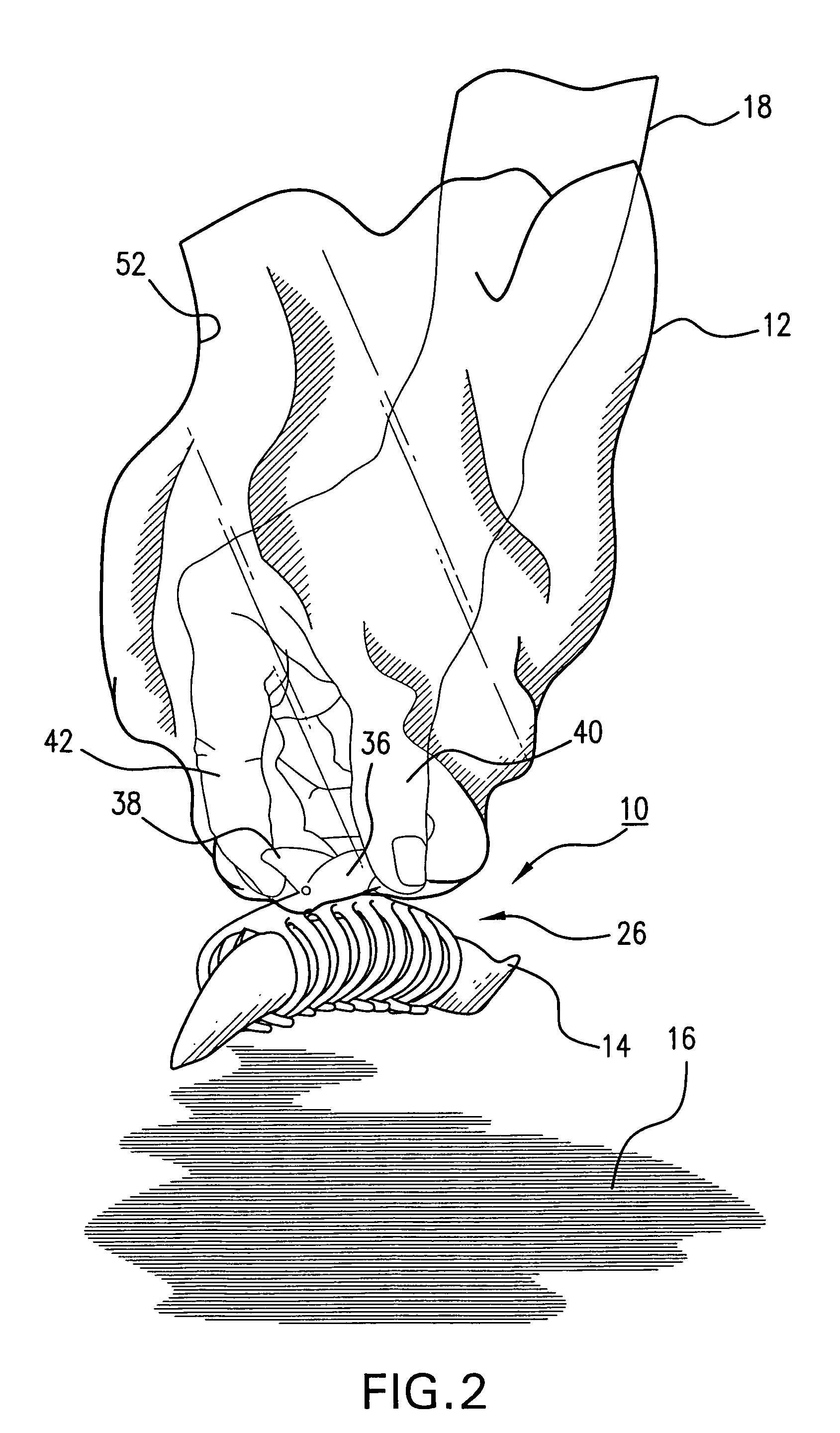 Refuse removal system and method for removing refuse