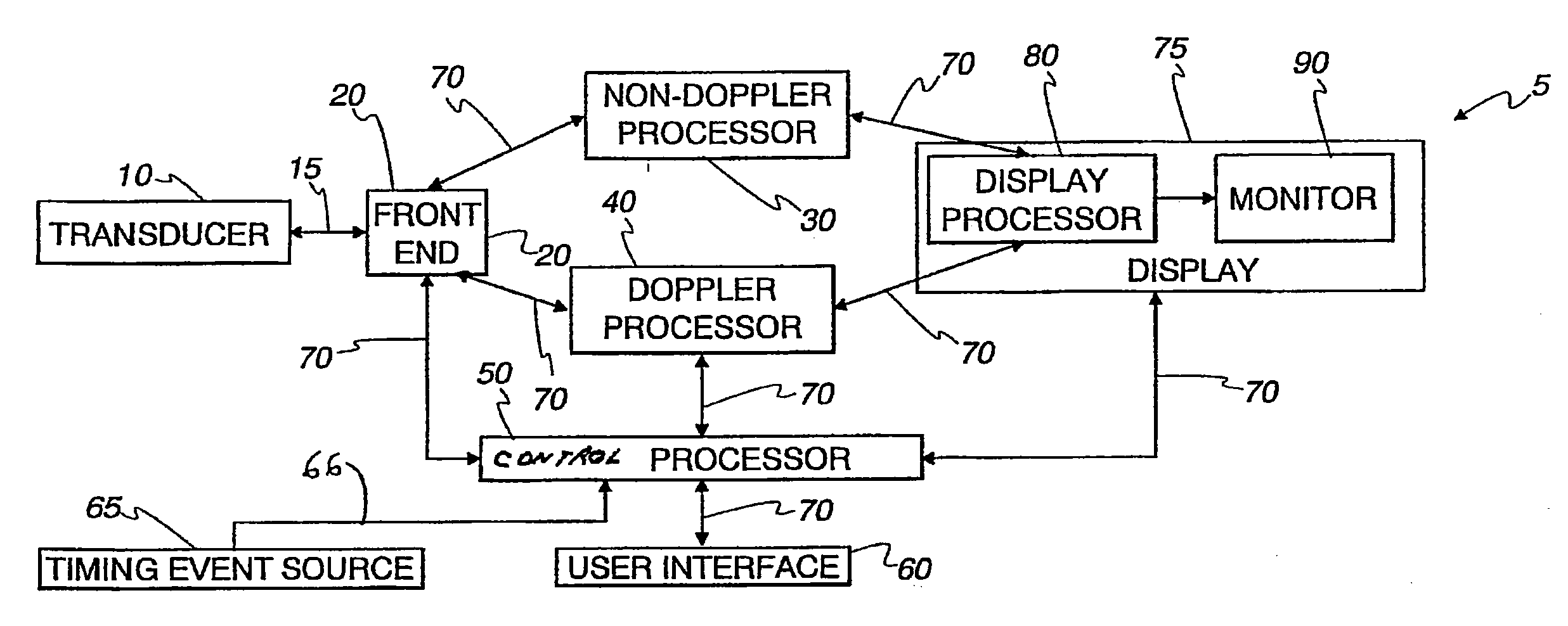 Ultrasound location of anatomical landmarks