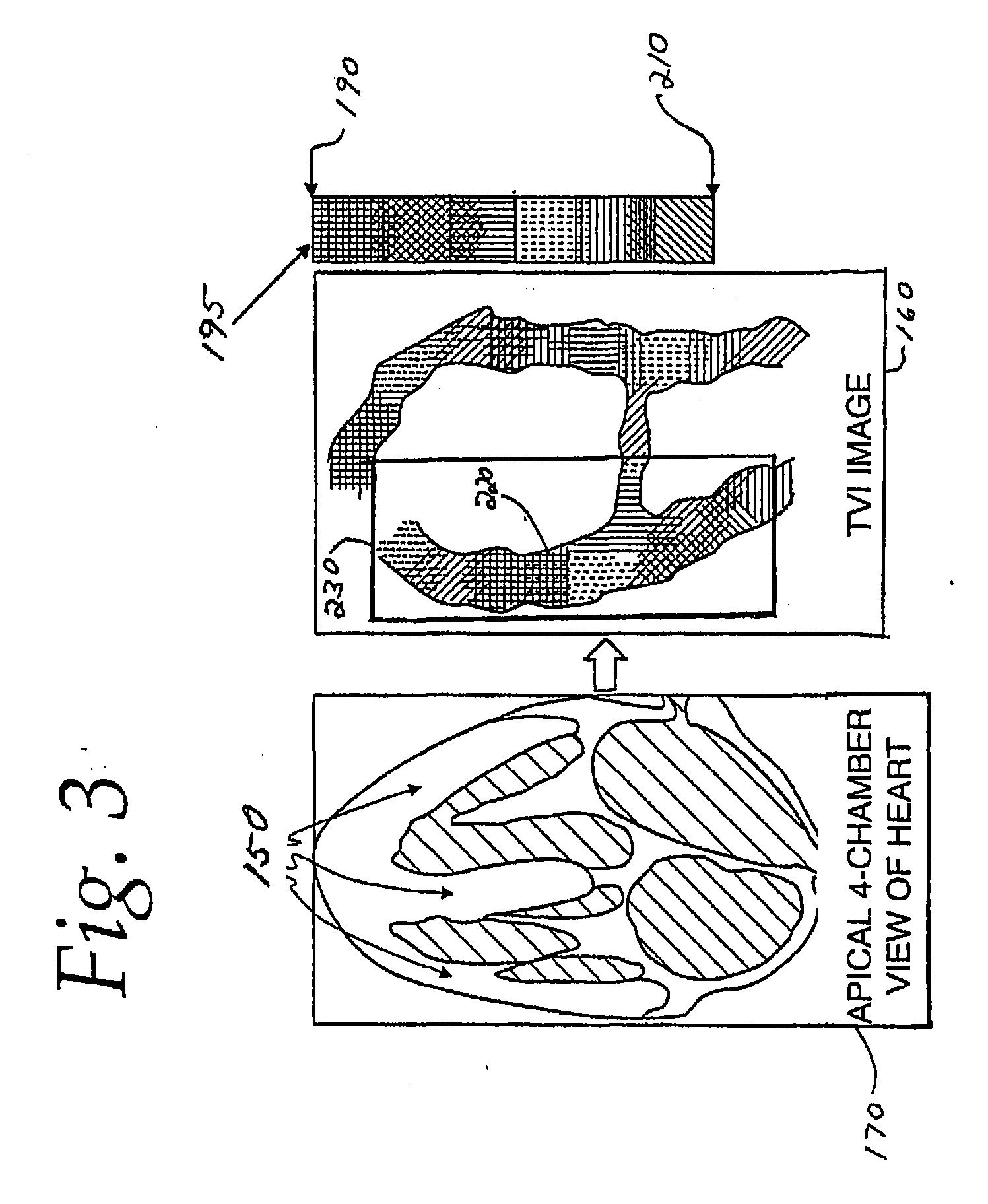 Ultrasound location of anatomical landmarks