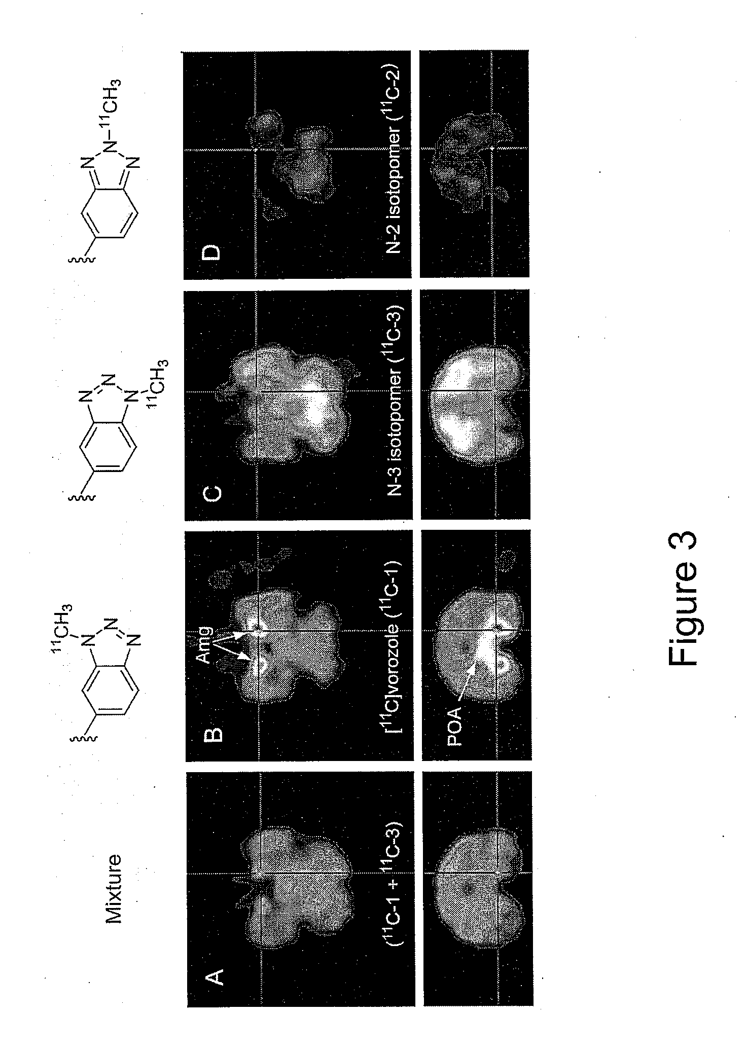 Radio-methyl Vorozole and Methods for Making and Using the Same