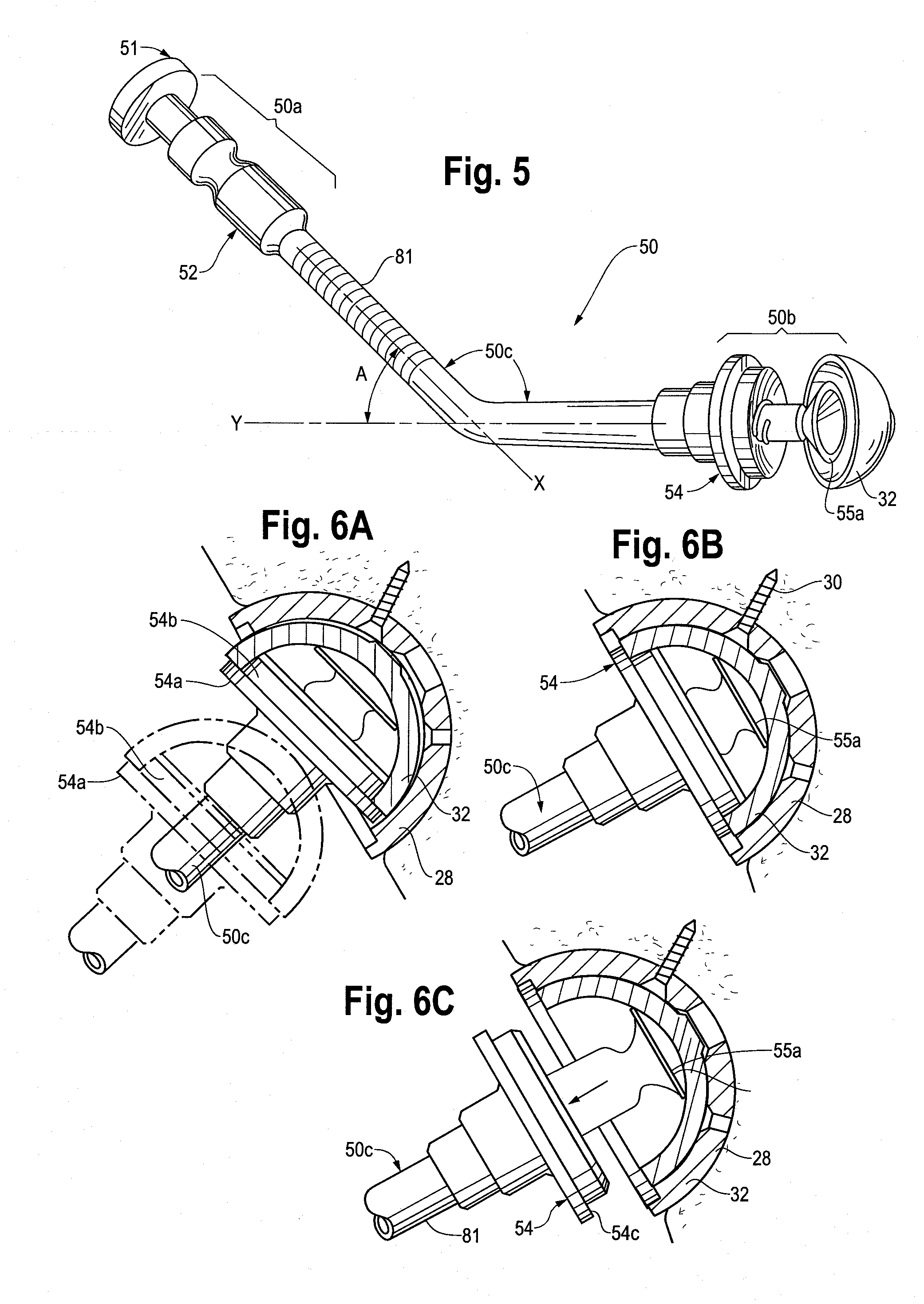Surgical insertion device for use in orthopedic surgery