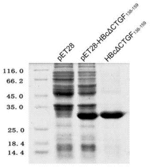 Connective tissue growth factor chimeric vaccine for treating liver fibrosis and its application