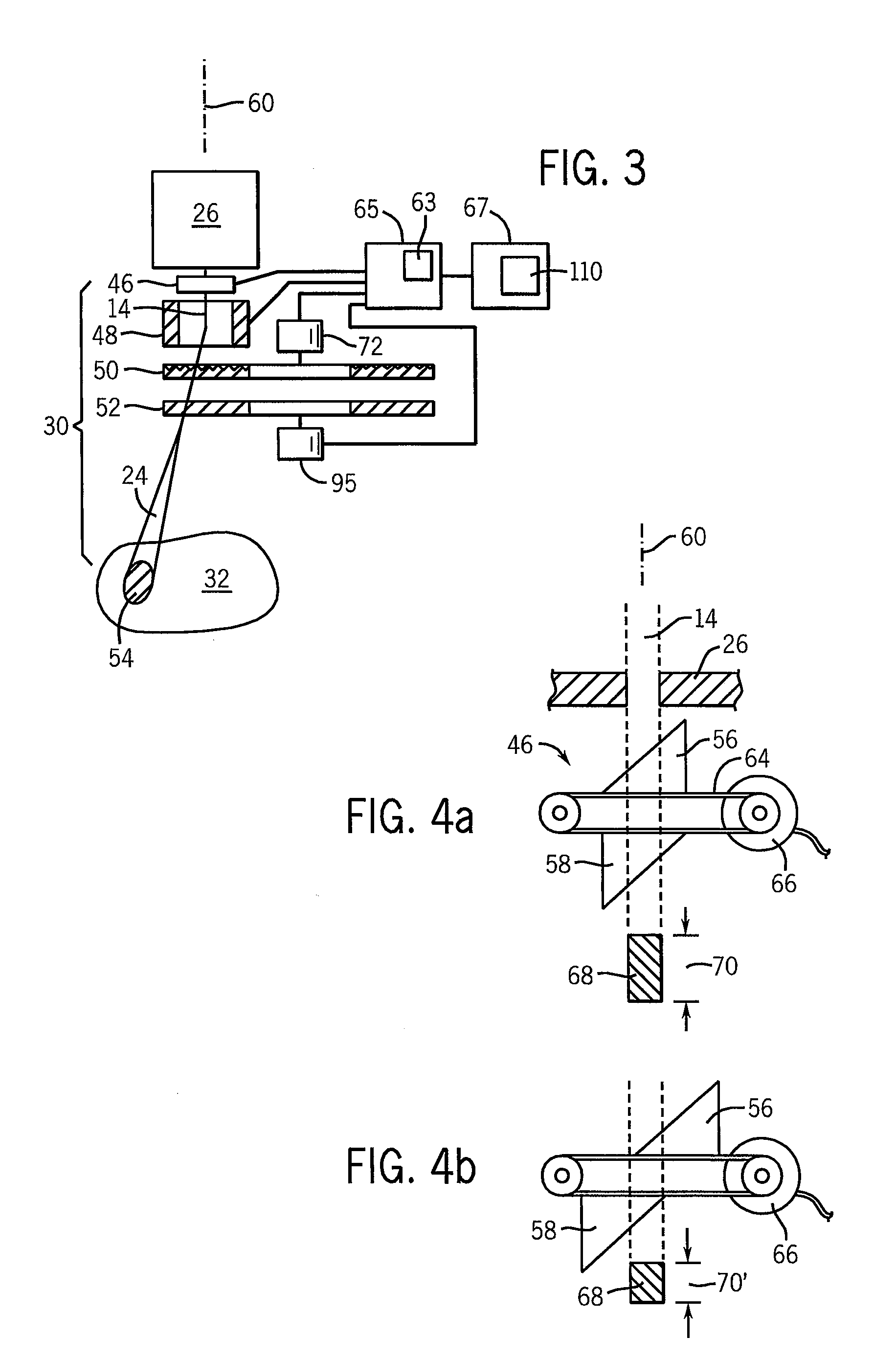 Ion radiation therapy system with variable beam resolution